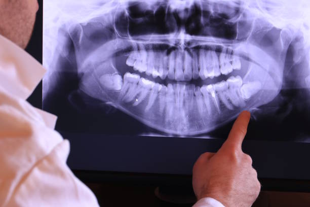 Best Emergency Root Canal Treatment in Murrysville, PA