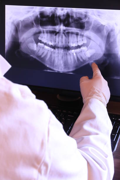 Best Emergency Dentist for Lost Fillings or Crowns in Murrysville, PA
